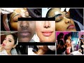 Aesthetic Permanent Semi Permanent Sin Door Laser Lip Depigmentation Saya Academy