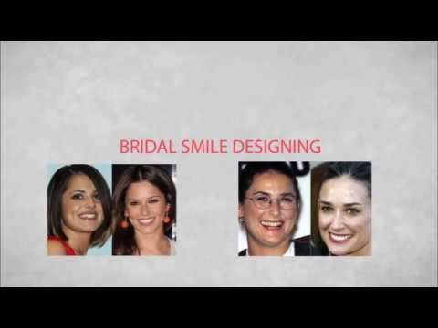 Bridal smile designing service at dental specialist in coimbatore