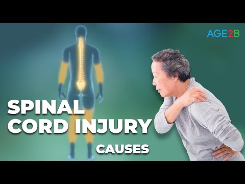 Causes of Spinal Cord Injuries | Causes, Effects and Classifications | Neuroanatomy