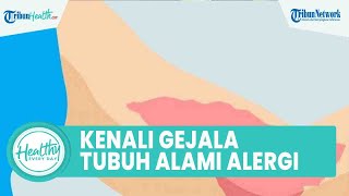 Kenali Gejala Tubuh Alami Alergi sejak Dini, dari Mata Berair hingga Demam Tinggi