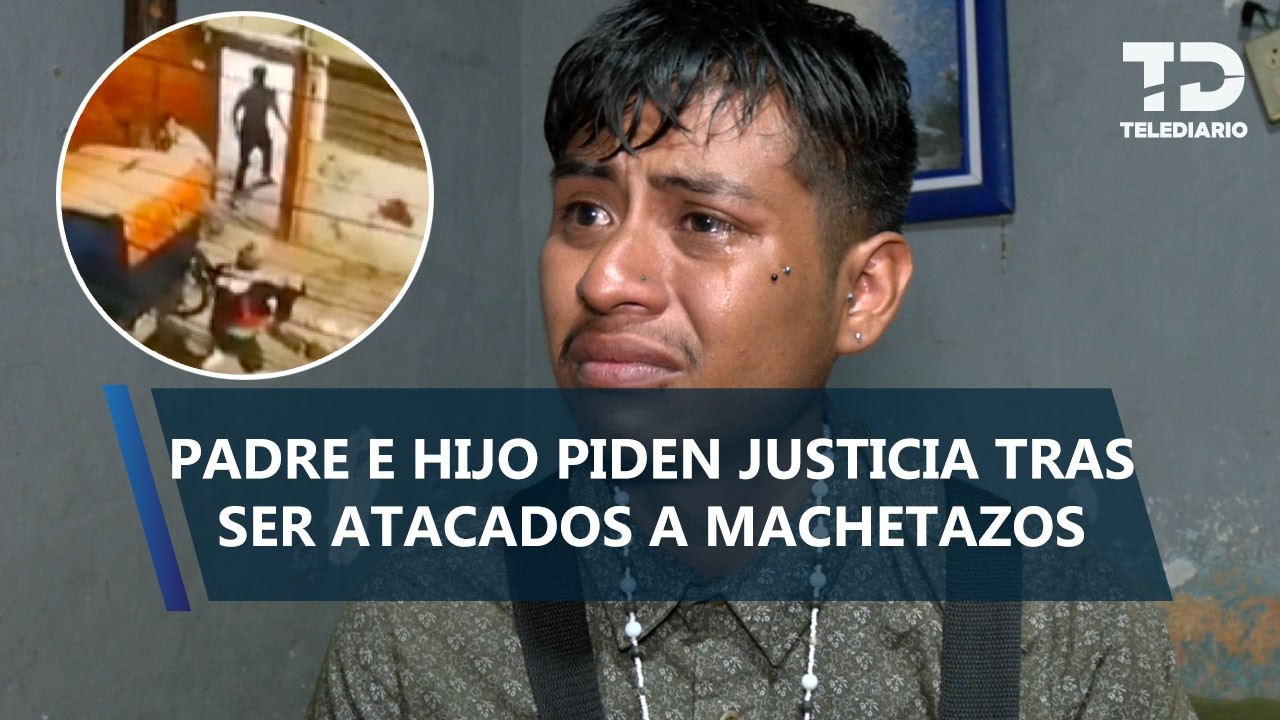 "Tengo miedo": José Alejandrino pide justicia tras ser atacado a 'machetazos' en Ecatepec