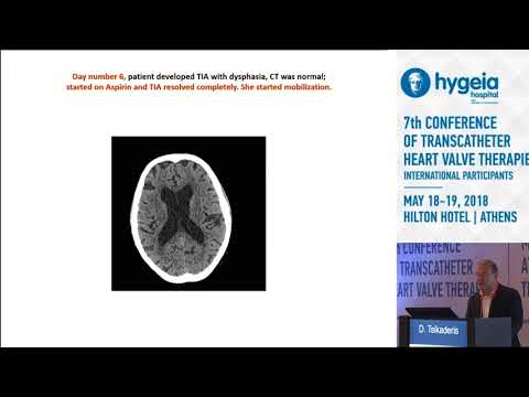 D.Tsikaderis  | My best and worst TAVR case of the year. The single most important lesson learned