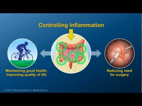 Chronic Inflammation in IBD and How Anti-TNF Therapy Works