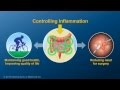 Chronic Inflammation in IBD and How Anti-TNF ...
