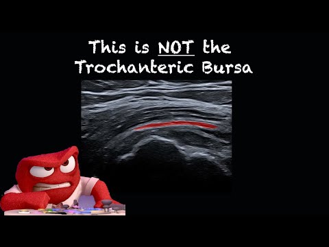Ultrasound of the Lateral Hip and Trochanteric Bursa