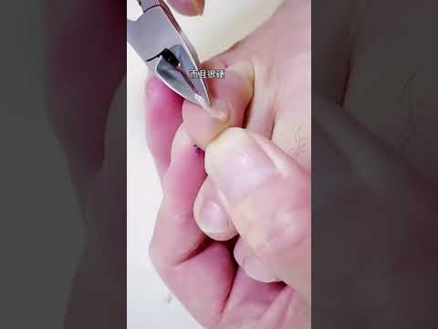 Detergent ciuperca unghiilor
