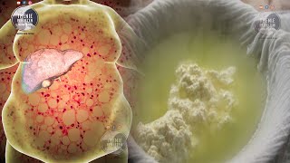 Kjo grua piu esëll një gotë hirrë për 30 dit, ja se çfarë i ndodhi me Mëlçinë më vonë