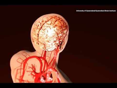 Scientists Reverse Alzheimer's Symptoms in Mice, Human Trials Are Next