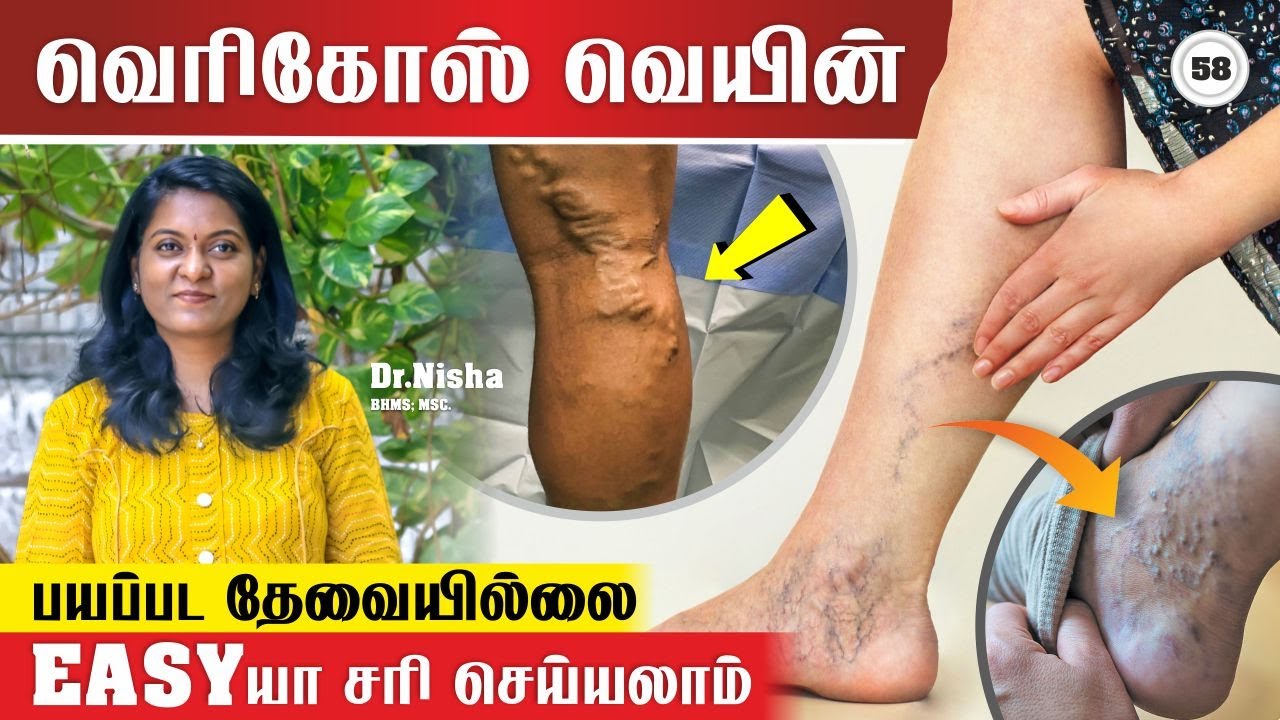 Dr.Nisha Madurai Homeopahy  video