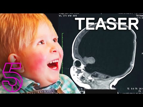 The Boy With No Brain | Extraordinary People | Channel 5