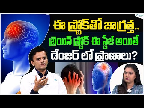 Stages of Brain Stroke You Must Know | Dangerous Stroke Symptoms Explained