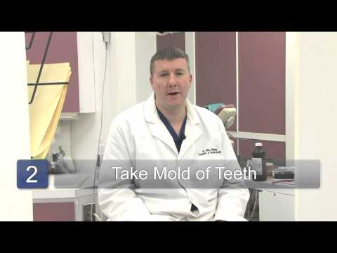 download lagu mp3 mp4 Veneers For Crooked Teeth, download lagu Veneers For Crooked Teeth gratis, unduh video klip Veneers For Crooked Teeth
