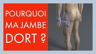 Sciatique: Perte de sensibilité, fourmillements jambe ou pied: pourquoi ma jambe dort 