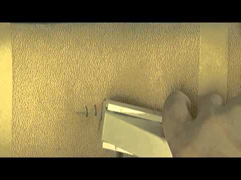 Skin Stapling & Removing Skin Staples