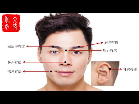 兩眉中間有痣