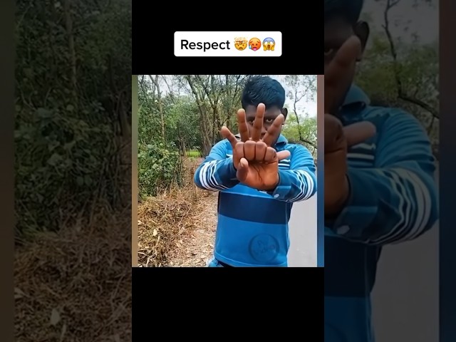 Vídeo relacionado con SquarezhenBo 2 piezas de color de piel de primera calidad para punta de pulgar mágico truco dedo de goma de primer plano desaparecer apariencia hanky truco Prop, suministros mágicos, novedad y