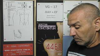 Опухоли Женских половых органов.