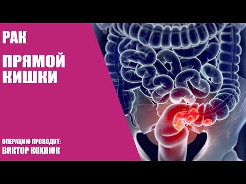 Ревматолог коленный суставы Боль слева от солнечного сплетения в спине