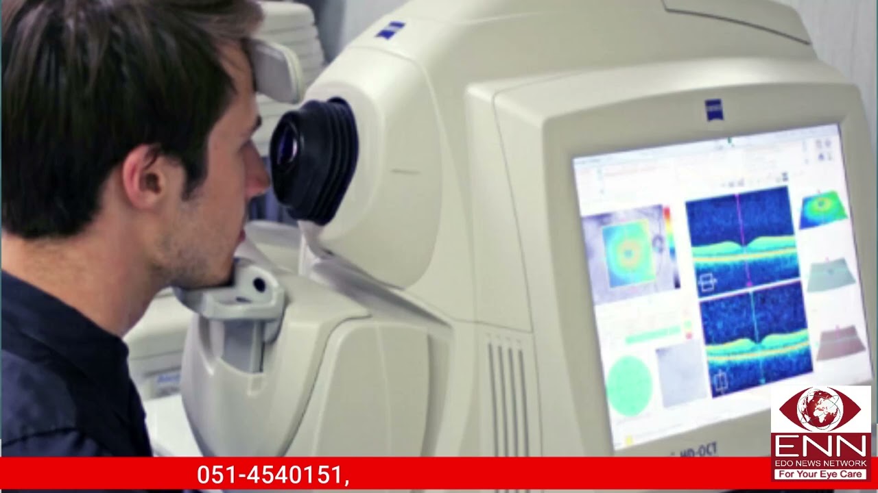 What Is Optical Coherence Tomography -OCT Test? | Scanning Of Eyes | Eyes Problem #eyetest #OCT #EDO