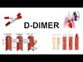 D -Dimer Blood tests(Clear overview) #Corona#Ddimer#Mls#Bloodclotting#Pulmonaryembolism.