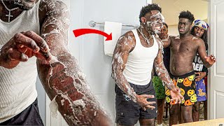 Disgusting Skin Prank!