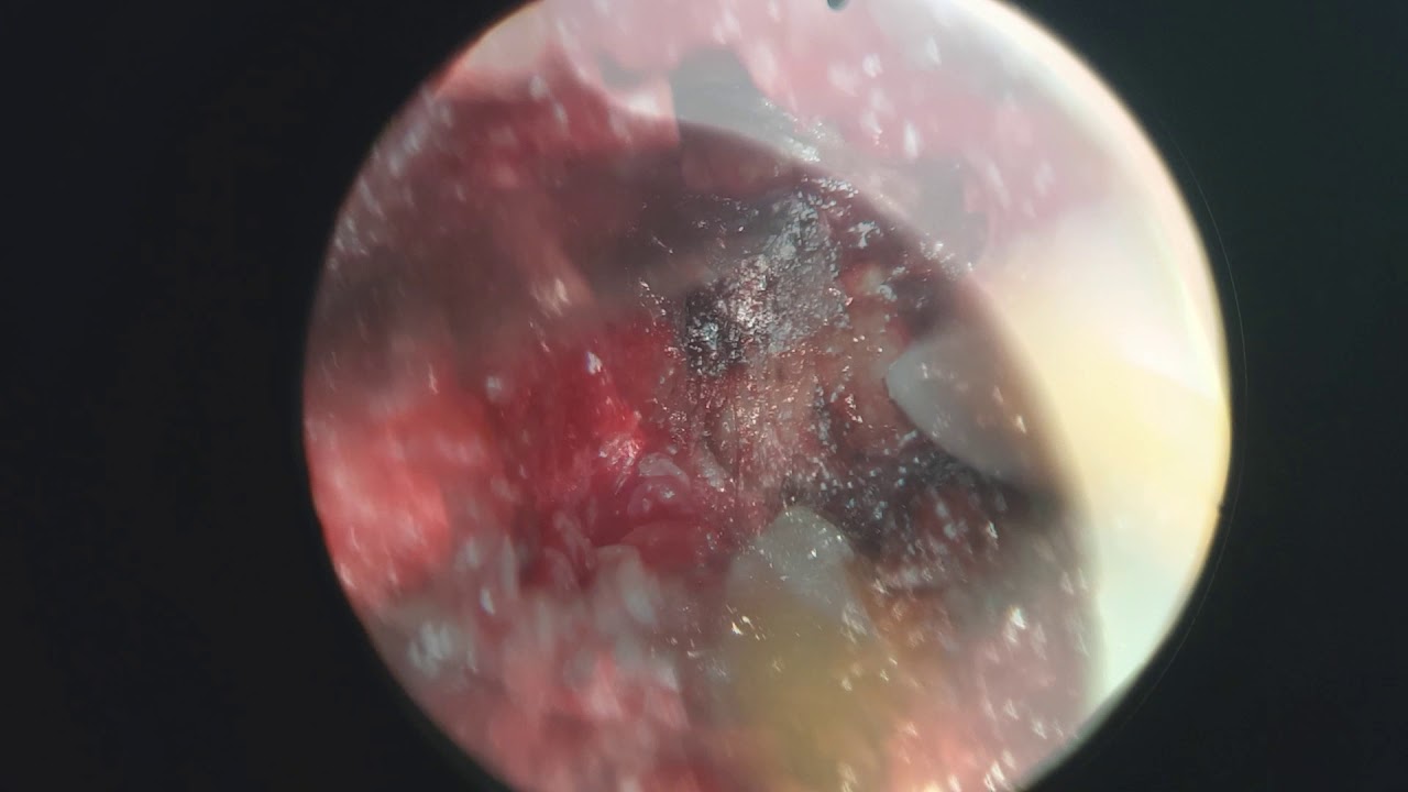 Nelson Alberto Morales Alba-1