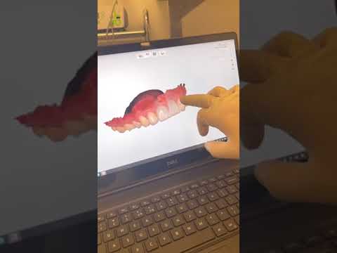 TAKE A DIGITAL INTRAORAL SCAN WITH US