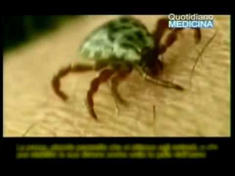 Metodi di ricerca il terreno su helminths Striscia la tosse facile