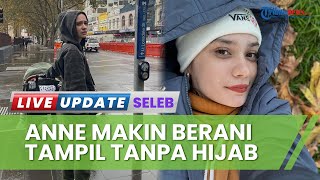 Putuskan Lepas Hijab, Putri Anne Kini Pamer Penampilan Baru dengan Rambut Tergerai Panjang