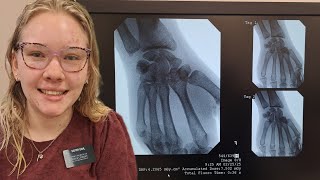 Last Day at Home before Leaving to the MTC - Seeing Orthopedic Surgeon about hand, Is It Broken?
