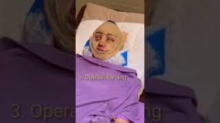 Download lagu Inilah Wajah Lucinta Luna Pasca Operasi mp3