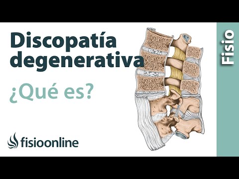 Può essere un dolore addominale con osteocondrosi radicolare Fisioterapia con ernia discale del rachide cervicale