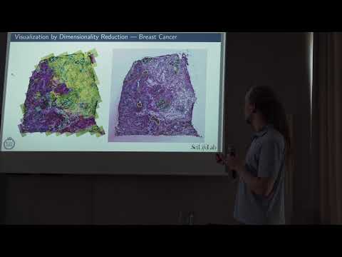 Jonas Maaskola - Charting Tissue Expression Anatomy by Spatial Transcriptome Deconvolution