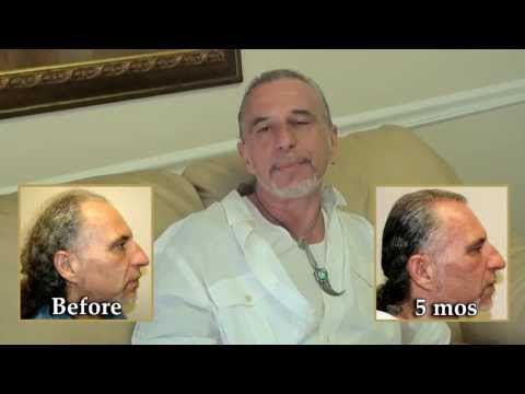 Minotti's Testimonial