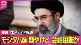 【最新イラン情勢】イラン最高指導者・モジタバ師は重傷…顔にやけど負い話すのが困難な状況か　米報道──国際ニュースライブ（日テレNEWS LIVE）
