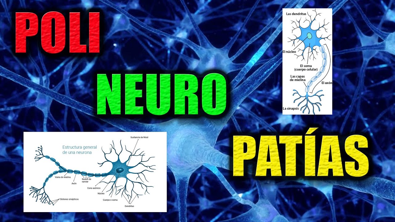 POLINEURORRADICULOPATÍAS