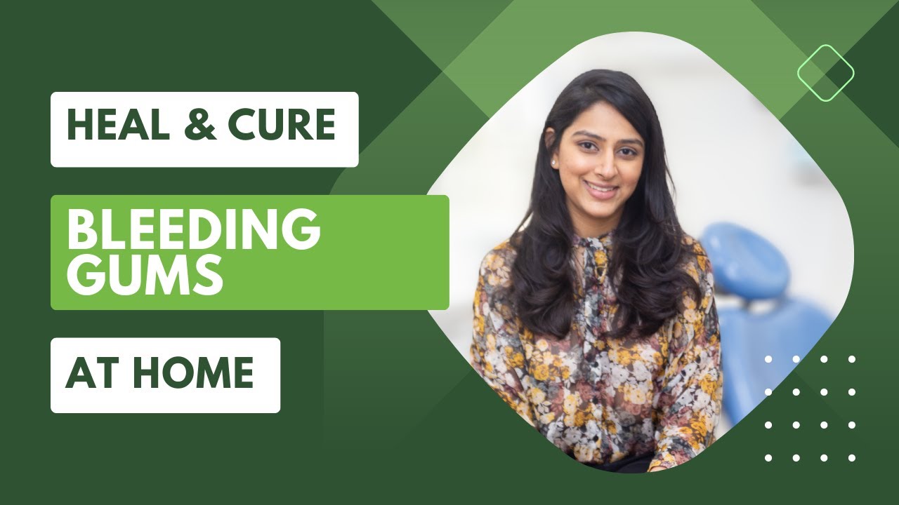 Say No to Bleeding Gums: Effective Home Remedies Revealed!