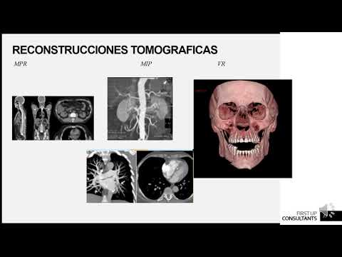 Presentación de contenido visto en el curso de Tomografía Axial Computada I