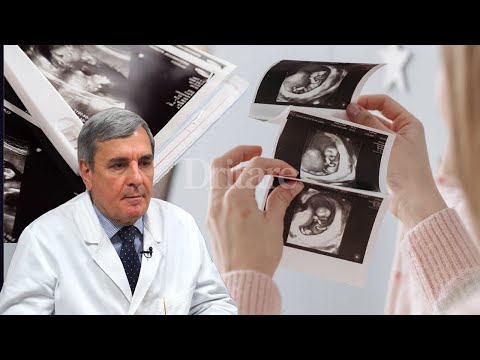 Fertilizimi in Vitro që sjell në jetë një bebe! | Dritarja e Doktorit