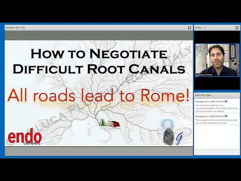 How To Negotiate Difficult Root Canals