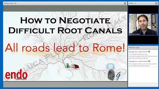 VDW Dental · Webinar: How To Negotiate Difficult Root Canals (EN)