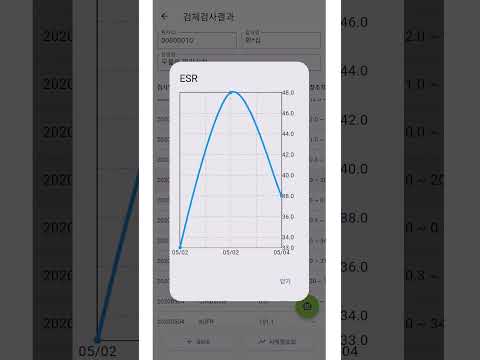 mchart