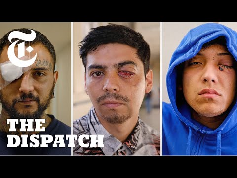 Chilean Police Are Blinding Protesters: We Spoke to the Injured | The Dispatch