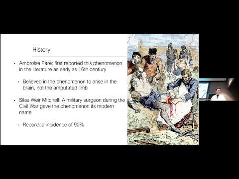 03.15.2024, “Current Strategies for the Management of Phantom Limb Pain”