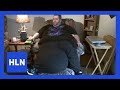 Watch: The man with the 100-lb scrotum