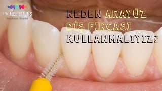 Neden arayüz diş fırçası kullanmalıyız