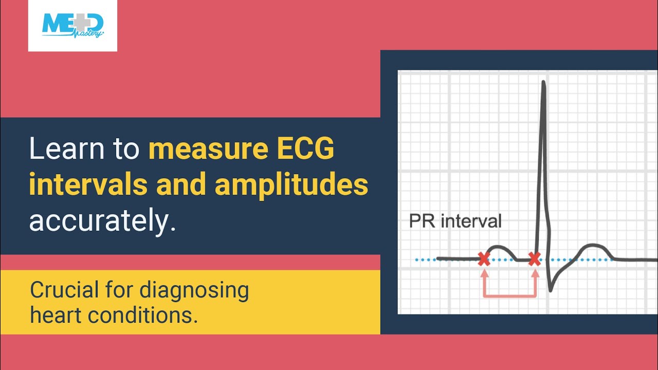 Interval and amplitude measurements