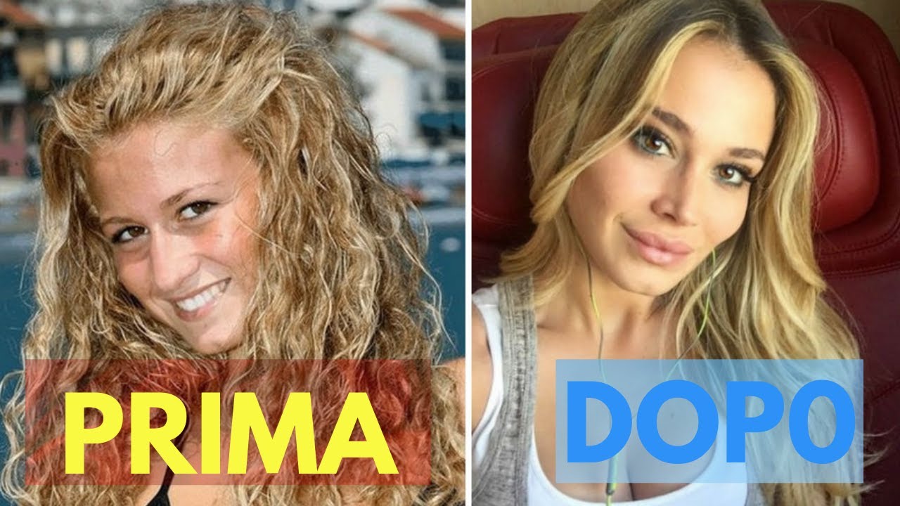 Vip rifatti-prima e dopo