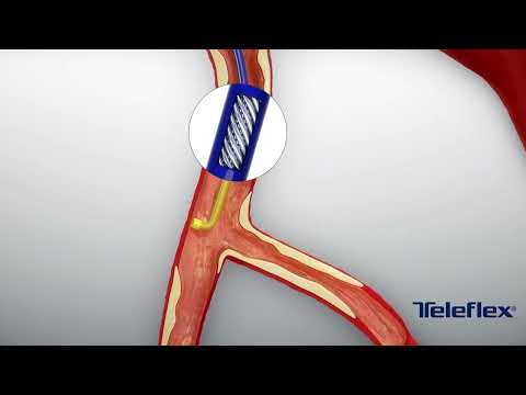 SuperCross™ Microcatheters
