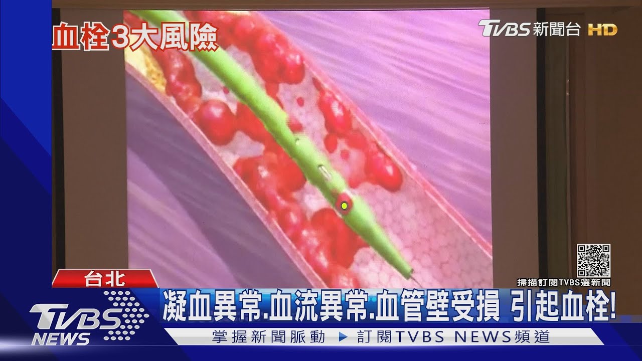 水喝太少又經常久站久坐　比AZ更容易血栓醫警告：別忽略這件事